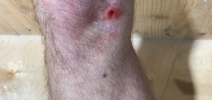 20181119 BattleScars img-002